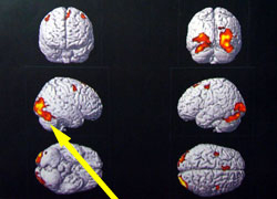 画像 | Functional（脳機能）MRI解析画像