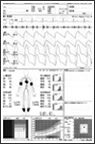血圧脳波検査解析結果