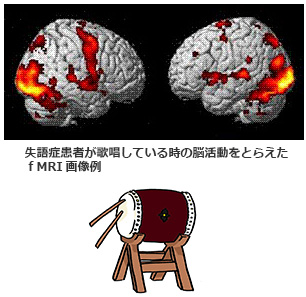 画像 | ｆＭＲＩが脳活動をとらえた瞬間